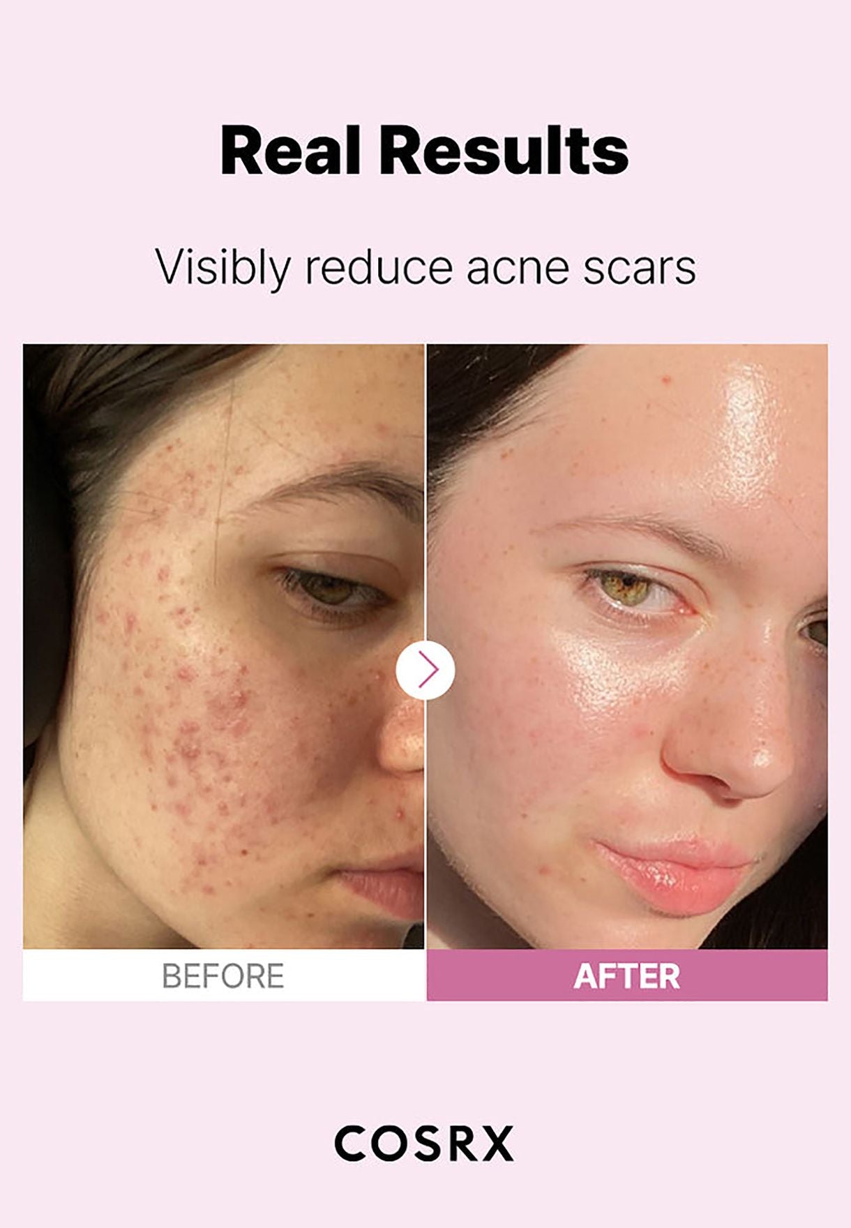 COSRX The Niacinamide 15