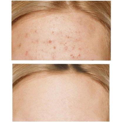 SOME BY MI AHA, BHA, PHA 30 DAYS MIRACLE CREAM 50ML